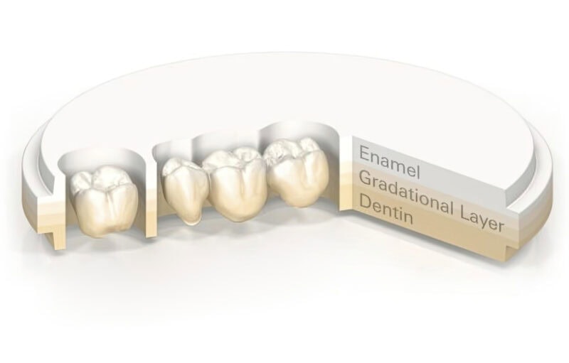 Corona Full Zirconia Multicapa – Prótesis dental 100% zirconia, translúcida y resistente, para una restauración duradera y estética 1