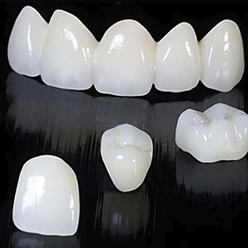Corona Full Zirconia Multicapa – Prótesis dental 100% zirconia, translúcida y resistente, para una restauración duradera y estética 2