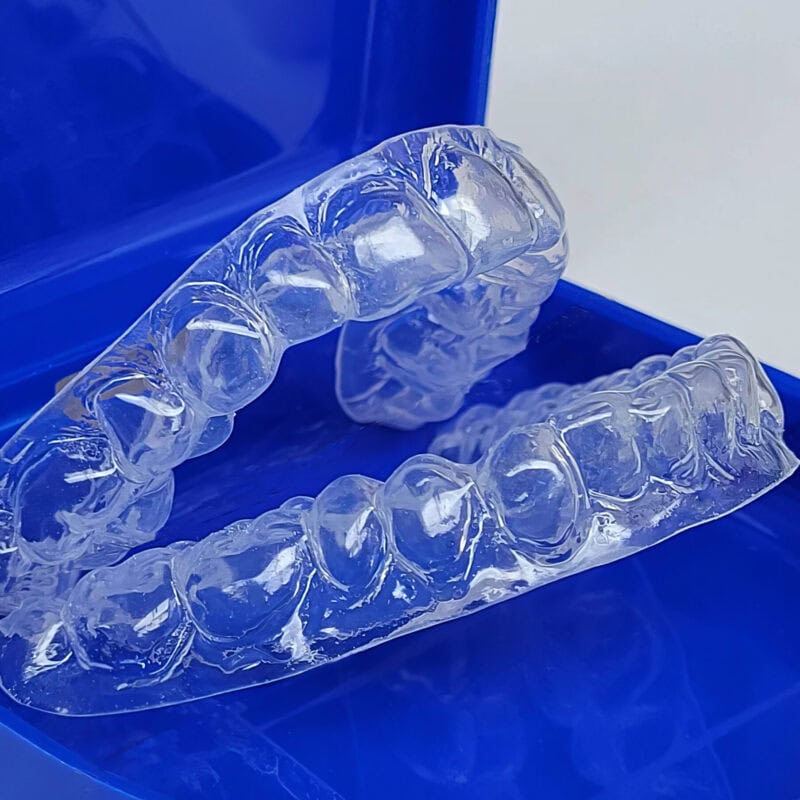 Férula de blanqueamiento a medida - Blanqueamiento eficaz y fluorización para reforzar el esmalte y mejorar la estética dental