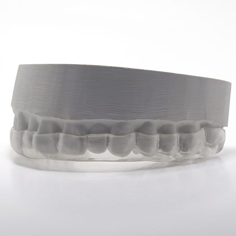 Férula de bruxismo a medida – Protección eficaz contra el rechinamiento de dientes y el desgaste dental