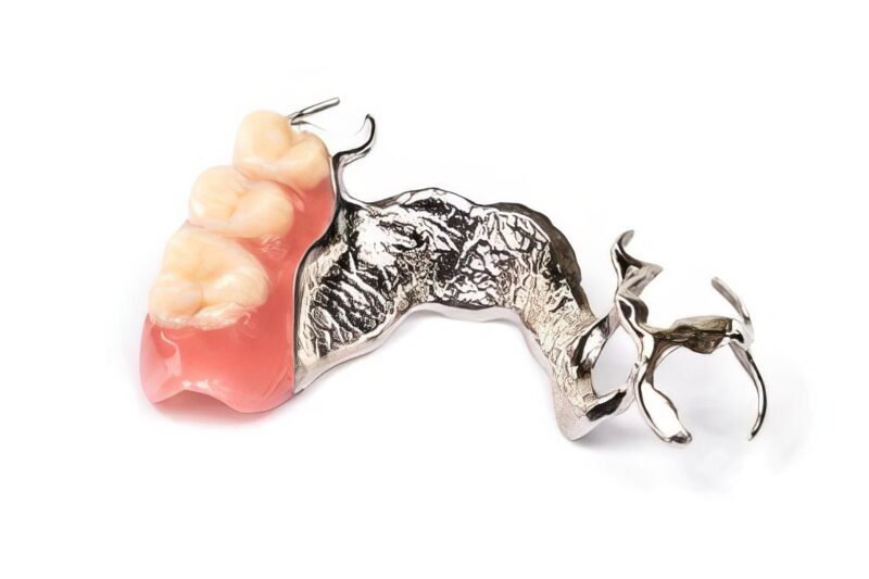 Prótesis dental removible stellite metal-resina 1