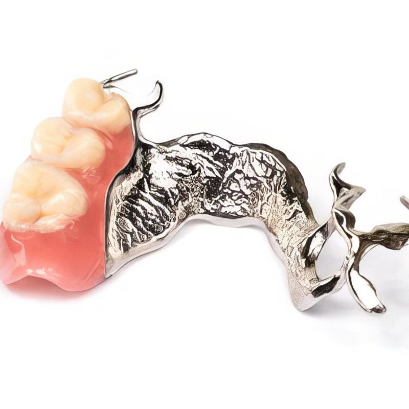 Prótesis dental removible stellite metal-resina 1
